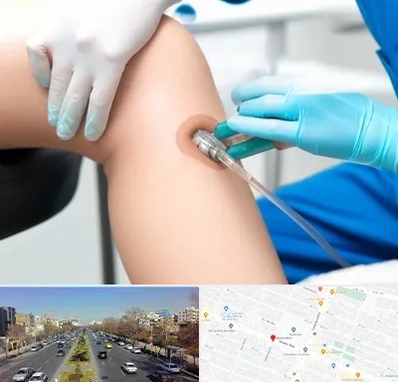 اوزون تراپی در بلوار معلم مشهد 