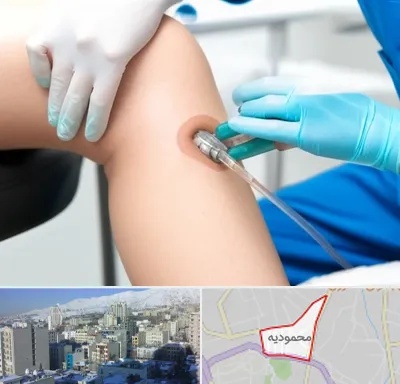 اوزون تراپی در محمودیه