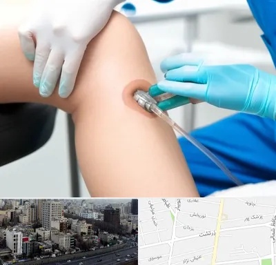اوزون تراپی در زرتشت