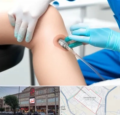 اوزون تراپی در قائمیه اسلامشهر 