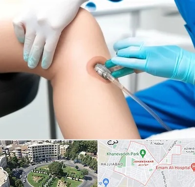 اوزون تراپی در جهانشهر کرج 