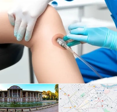 اوزون تراپی در عفیف آباد شیراز 