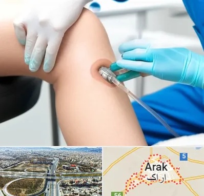 اوزون تراپی در اراک