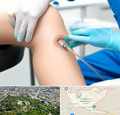 اوزون تراپی در شهرکرد