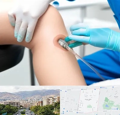 اوزون تراپی در خانی آباد