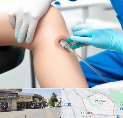 اوزون تراپی در پرواز تبریز 