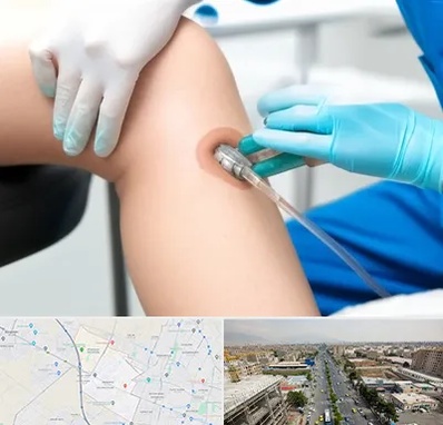 اوزون تراپی در حصارک کرج 