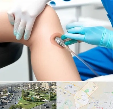 اوزون تراپی در کمال شهر کرج 