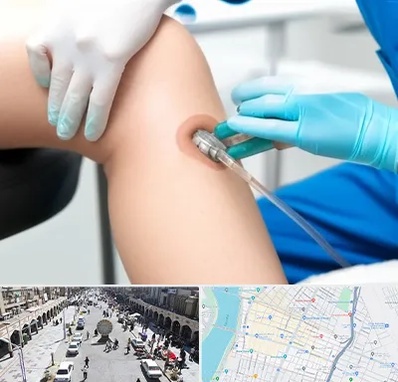 اوزون تراپی در نادری اهواز 