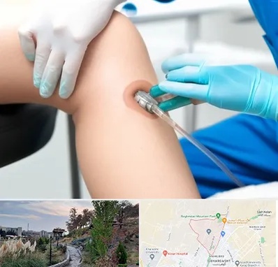 اوزون تراپی در باغستان کرج 