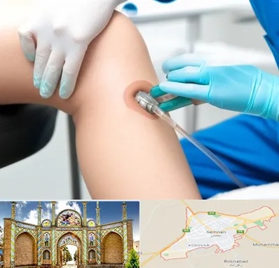 اوزون تراپی در سمنان