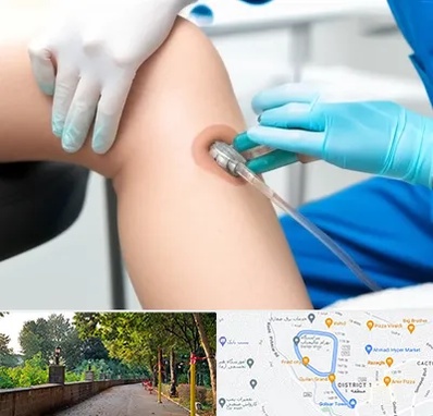 اوزون تراپی در فلکه گاز رشت 