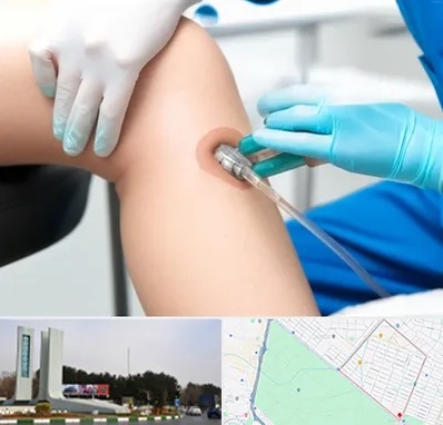 اوزون تراپی در بلوار فلسیطین مشهد 