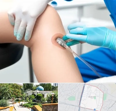 اوزون تراپی در باغمیشه تبریز 