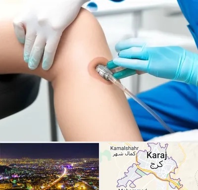 اوزون تراپی در کرج