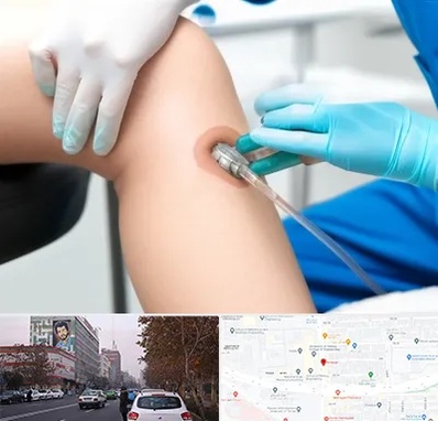 اوزون تراپی در کارگر شمالی
