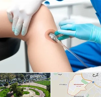 اوزون تراپی در مهرشهر کرج 