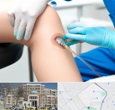 اوزون تراپی در طلاب مشهد 