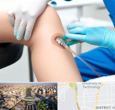 اوزون تراپی در استاد معین