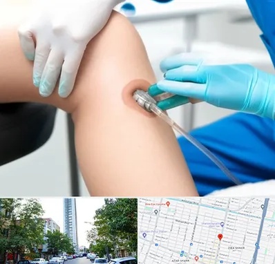 اوزون تراپی در امامت مشهد 