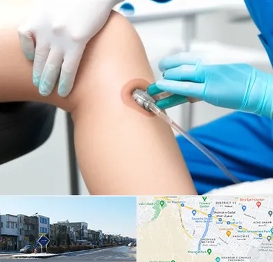 اوزون تراپی در شریعتی مشهد 