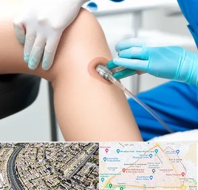 اوزون تراپی در شهرک غرب مشهد 