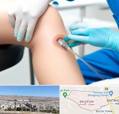 اوزون تراپی در شهرک گلستان شیراز 