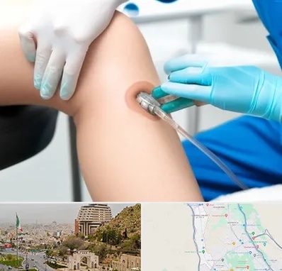 اوزون تراپی در فرهنگ شهر شیراز 