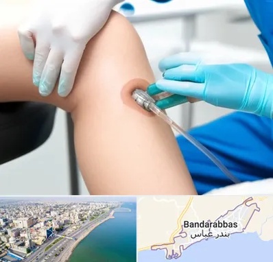 اوزون تراپی در بندرعباس