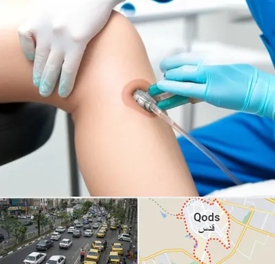 اوزون تراپی در شهر قدس