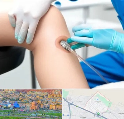 اوزون تراپی در رشدیه تبریز 