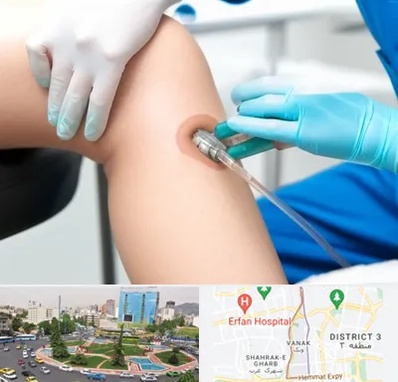 اوزون تراپی در ونک 