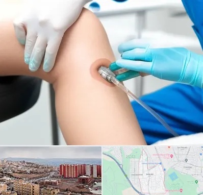 اوزون تراپی در سهند تبریز 