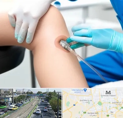 اوزون تراپی در جنوب تهران 