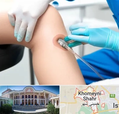 اوزون تراپی در خمینی شهر