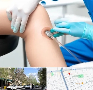 اوزون تراپی در کوی فیروز تبریز 