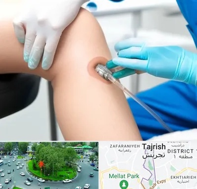 اوزون تراپی در تجریش 