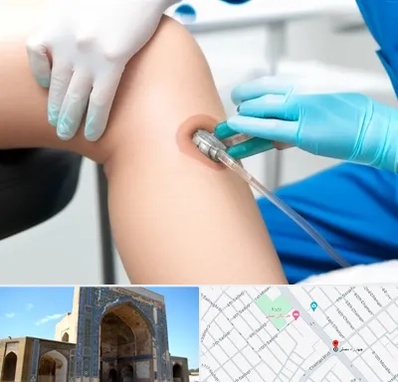 اوزون تراپی در مصلی مشهد 