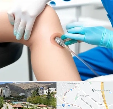 اوزون تراپی در شهر زیبا 