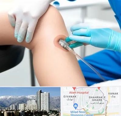 اوزون تراپی در شهرک غرب
