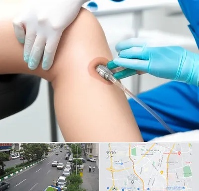 اوزون تراپی در ستارخان 