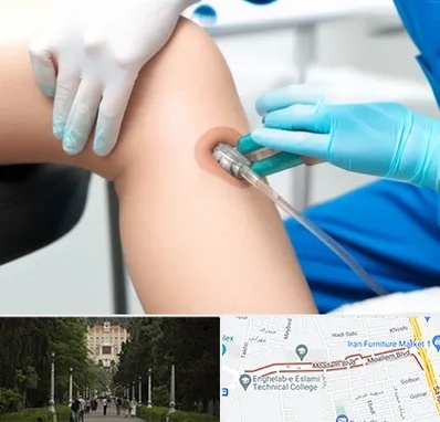 اوزون تراپی در بلوار معلم رشت 