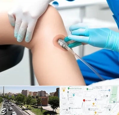اوزون تراپی در شهرک آزمایش 