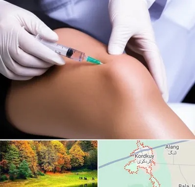پلاسما درمانی PRP در کردکوی