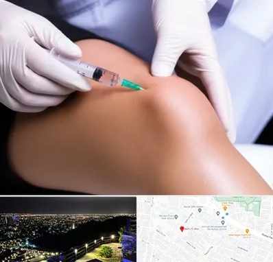 پلاسما درمانی PRP در هفت تیر مشهد 