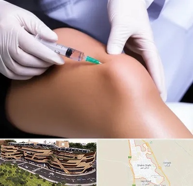 پلاسما درمانی PRP در شاهین شهر