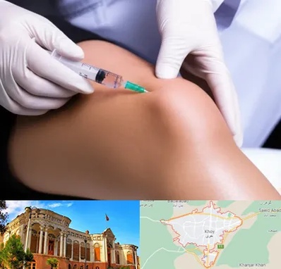 پلاسما درمانی PRP در خوی