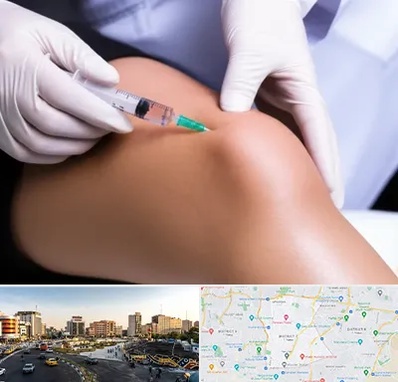 پلاسما درمانی PRP در منطقه 7 تهران 