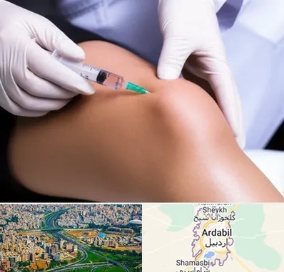 پلاسما درمانی PRP در اردبیل