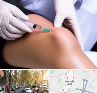 پلاسما درمانی PRP در کاشانک